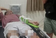 WNA Asal Belanda Alami Kecelakaan Tunggal di Patuk