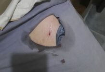 Petugas Jaga TPR Parangtritis Bantul Menjadi Korban “Klitih”